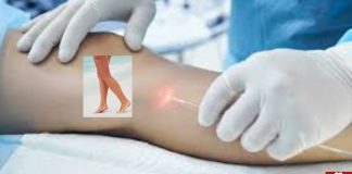 Varis Tedavisinde Anestezi